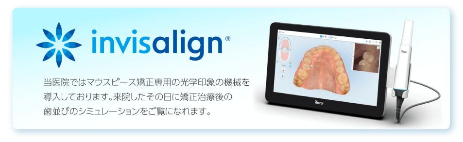 invisalign マウスピース矯正専用の光学印象の機械